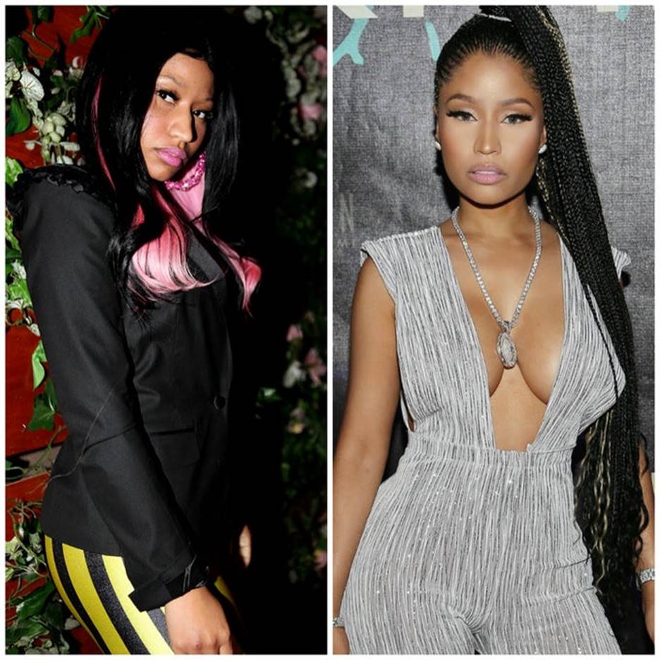 Nicki Minaj S Before And After Plastic Surgery Photos Look Extremely Different Ags Tools